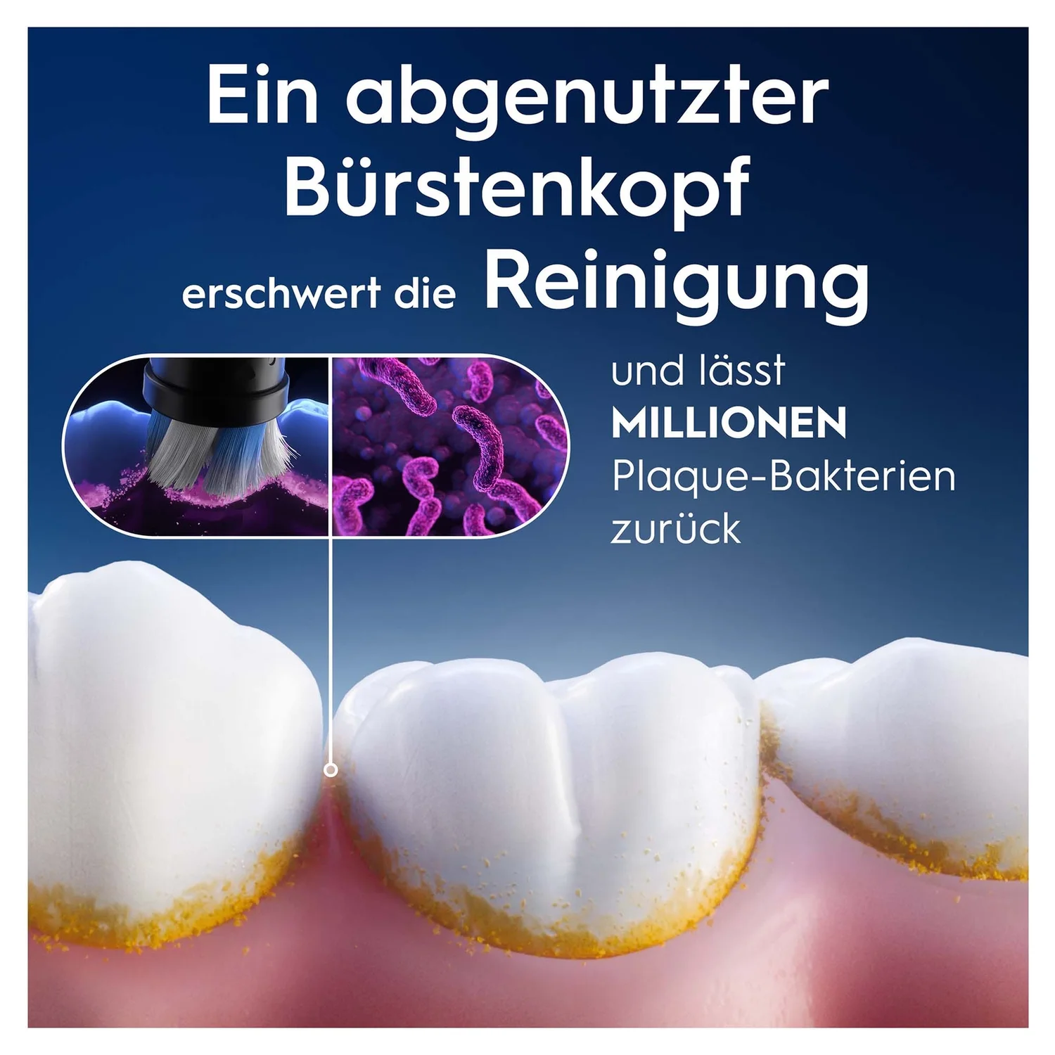 Braun Oral-B iO Sanfte Reinigung Zahnbürstenaufsätze
